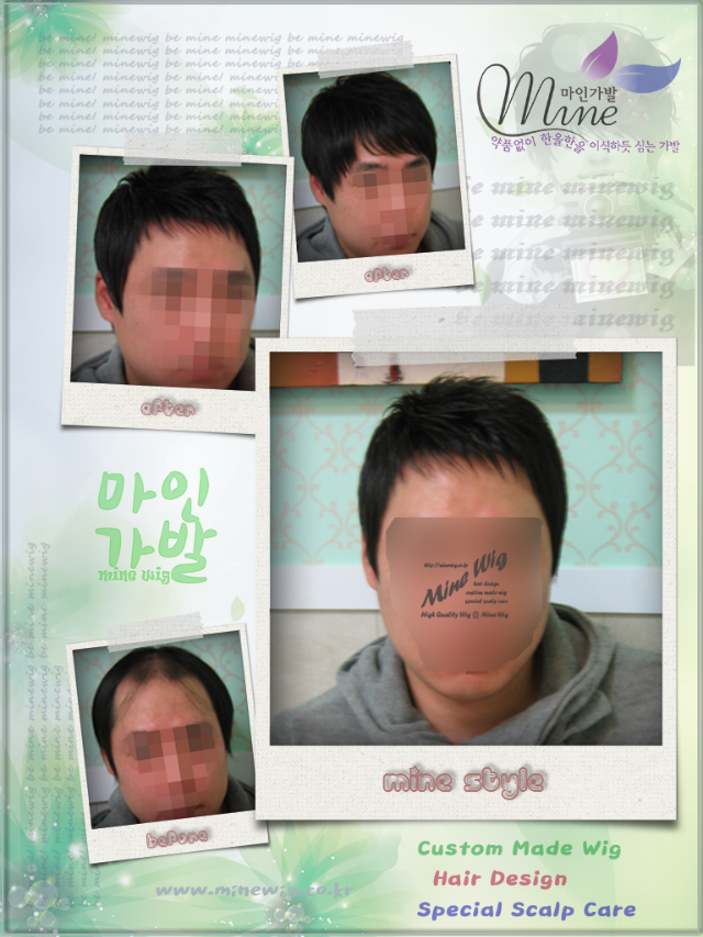 수정-남성5.png