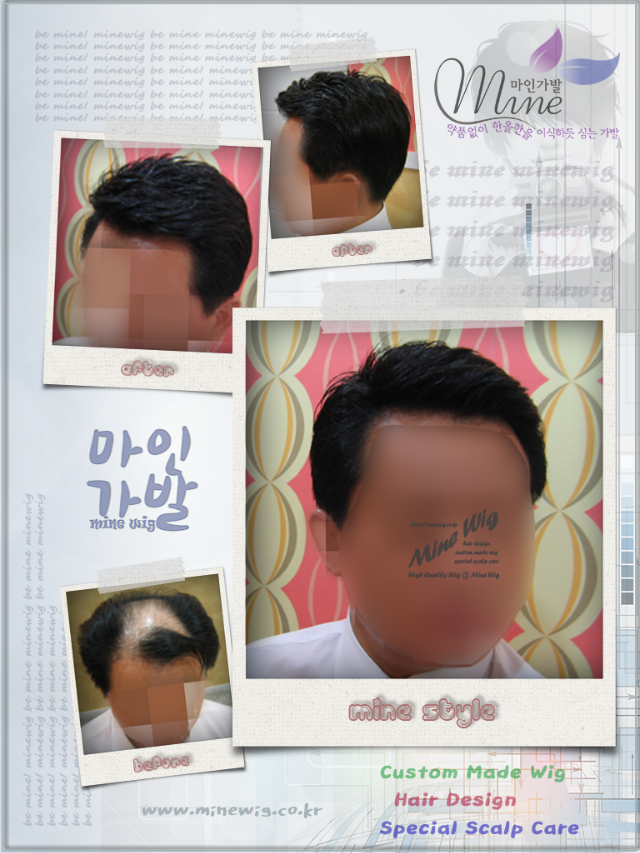 수정-남성1.png
